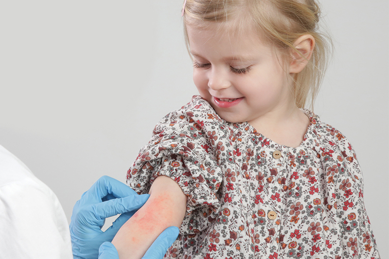 Child being treated for eczema by dermatologist