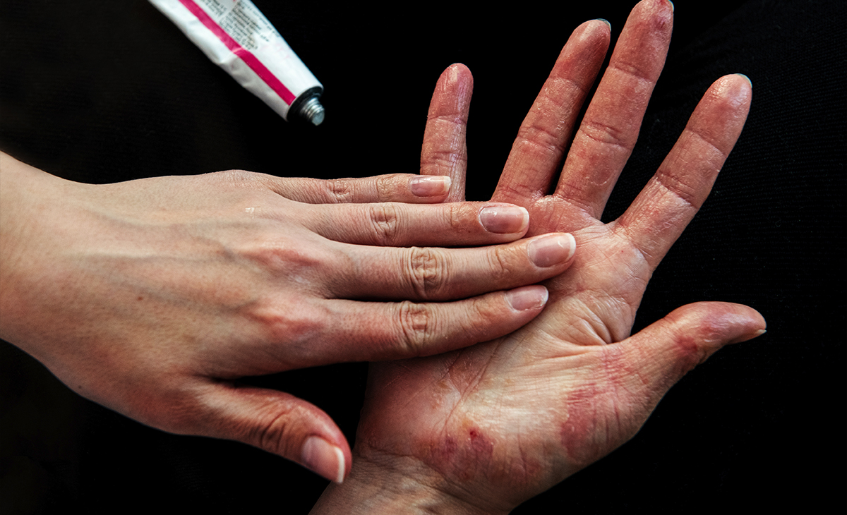 Medical Dermatology for skin conditions like eczema